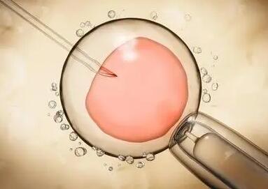 试管婴儿胚胎着床不成功的表现其中括流血吗
